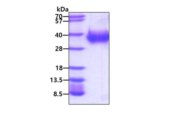 3 μg by SDS-PAGE under reducing condition and visualized by coomassie blue stain